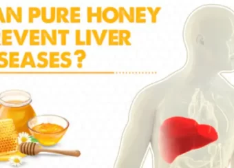 Honey Prevent Liver Diseases